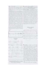 Feadóg Pro D Black Whistle Pack - Image 3